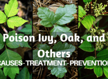 poison oak, poison sumac, poison oak, first aid, treatment, prevention, prepper, preparedness, shtf